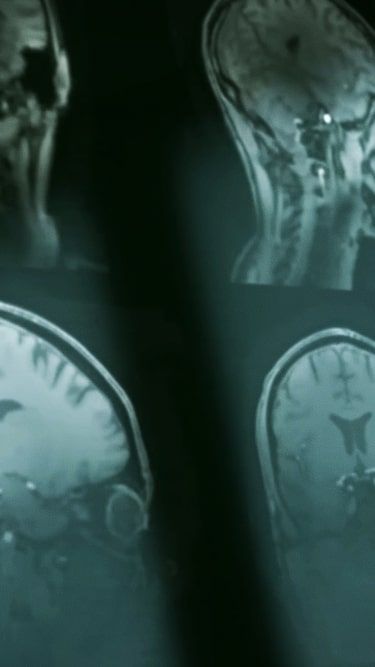 X-Rays showing a human head and brain